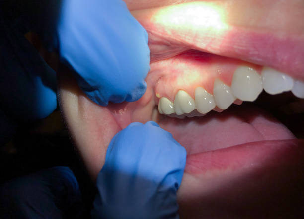 Best Dentist Open Late Near Me  in Fort Rucker, AL